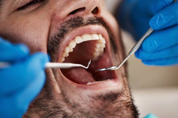 Best Emergency Cosmetic Dentistry (e.g., broken veneers) in Fraser, MI